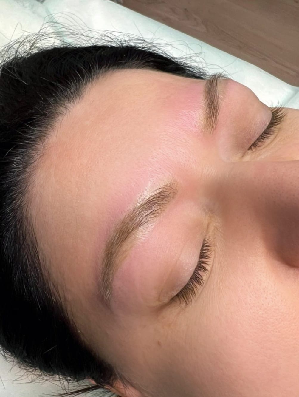Après détatouage, Institut Skin-Line