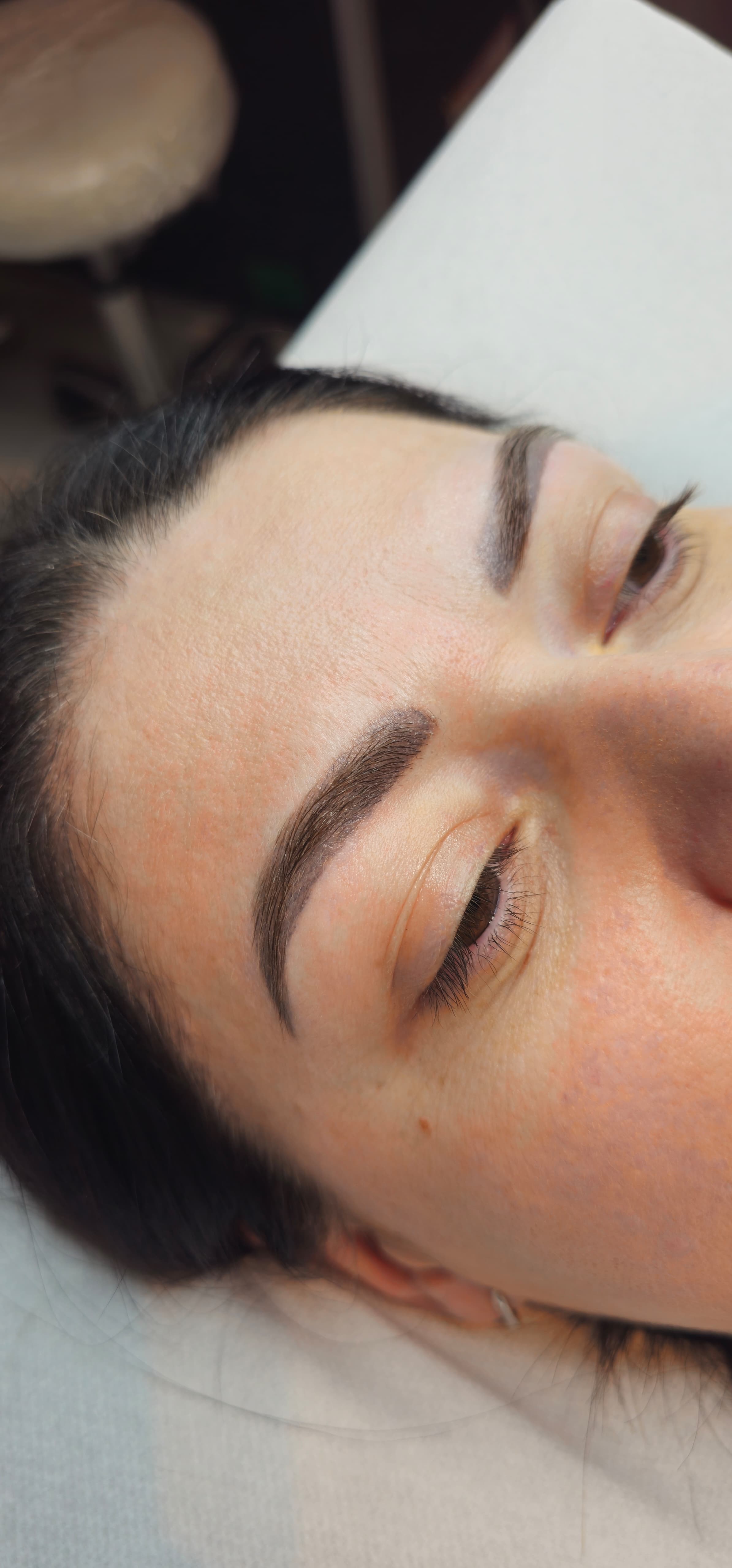 Avant détatouage, Institut Skin-Line